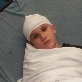 Dylan had a seizure and busted his head open, he got got seven staples.